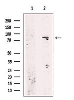 RhoBTB1/RhoBTB2 Polyclonal Antibody