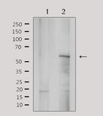 YTHDF1 Polyclonal Antibody