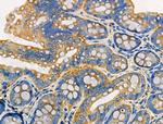 EPS8L2 Antibody in Immunohistochemistry (Paraffin) (IHC (P))