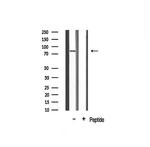 EPS8L2 Antibody in Western Blot (WB)