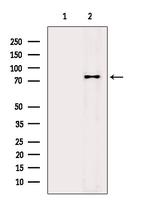 EPS8L2 Antibody in Western Blot (WB)