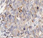 MUC13 Antibody in Immunohistochemistry (Paraffin) (IHC (P))