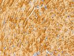 MUC13 Antibody in Immunohistochemistry (Paraffin) (IHC (P))