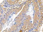 MUC13 Antibody in Immunohistochemistry (Paraffin) (IHC (P))