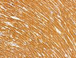 MUC13 Antibody in Immunohistochemistry (Paraffin) (IHC (P))