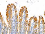 MUC13 Antibody in Immunohistochemistry (Paraffin) (IHC (P))
