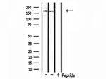 Collagen IV Polyclonal Antibody