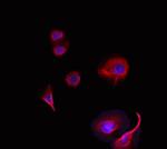 DIRAS1 Polyclonal Antibody