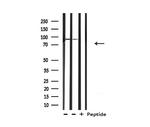 BCAR3 Antibody in Western Blot (WB)