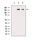 MRC2 Antibody in Western Blot (WB)