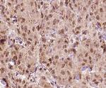 MAGE1 Antibody in Immunohistochemistry (Paraffin) (IHC (P))