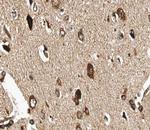 GUCY1B3 Polyclonal Antibody