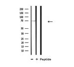 GUCY1B3 Antibody in Western Blot (WB)