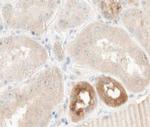 TNFAIP2 Polyclonal Antibody