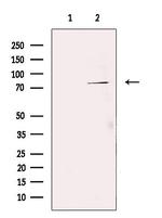TNFAIP2 Antibody in Western Blot (WB)