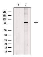 TNFAIP2 Antibody in Western Blot (WB)