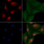 NeuroD2 Polyclonal Antibody