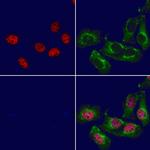 NeuroD2 Antibody in Immunocytochemistry (ICC/IF)