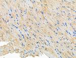 CERKL Polyclonal Antibody