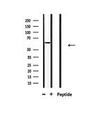 CERKL Antibody in Western Blot (WB)