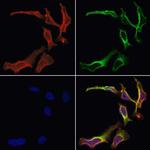 AKAP2 Polyclonal Antibody