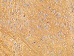 RNF144A Polyclonal Antibody