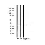 RNF144A Antibody in Western Blot (WB)