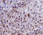 CDKL4 Antibody in Immunohistochemistry (Paraffin) (IHC (P))