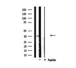CDKL4 Antibody in Western Blot (WB)