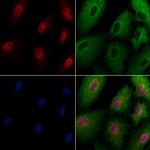 AK6 Polyclonal Antibody