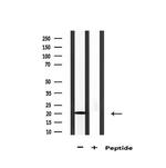 AK6 Antibody in Western Blot (WB)