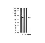 GAD65/GAD67 Antibody in Western Blot (WB)