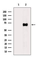 GAD65/GAD67 Antibody in Western Blot (WB)