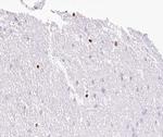 MOK Polyclonal Antibody