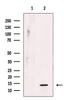 RPL31 Antibody in Western Blot (WB)