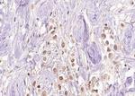 Phospho-ERK1/ERK2 (Tyr204) Antibody in Immunohistochemistry (Paraffin) (IHC (P))