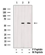 Phospho-AKT1/AKT2/AKT3 (Tyr315, Tyr316, Tyr312) Antibody in Western Blot (WB)