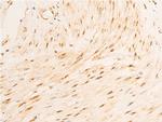 Phospho-GSK3B (Ser9) Antibody in Immunohistochemistry (Paraffin) (IHC (P))