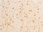 Phospho-GSK3B (Ser9) Antibody in Immunohistochemistry (Paraffin) (IHC (P))