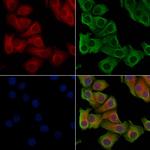 Phospho-ULK1 (Ser317) Polyclonal Antibody