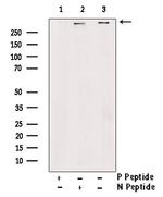 Phospho-RyR2 (Ser2814) Polyclonal Antibody