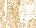 Acetyl-FOXO1 (Lys294) Polyclonal Antibody