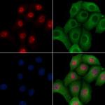 Phospho-4EBP1 (Ser65, Thr70) Polyclonal Antibody