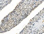 Phospho-4EBP1 (Ser65, Thr70) Antibody in Immunohistochemistry (Paraffin) (IHC (P))