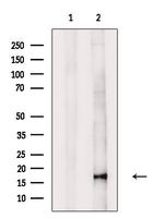 Phospho-4EBP1 (Ser65, Thr70) Antibody in Western Blot (WB)