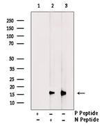Phospho-4EBP1 (Ser65, Thr70) Antibody in Western Blot (WB)