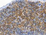 Phospho-ALK (Tyr1604) Polyclonal Antibody
