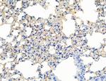Phospho-ALK (Tyr1604) Antibody in Immunohistochemistry (Paraffin) (IHC (P))
