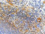 Phospho-ALK (Tyr1604) Antibody in Immunohistochemistry (Paraffin) (IHC (P))