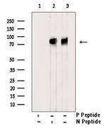 Phospho-ALK (Tyr1604) Antibody in Western Blot (WB)